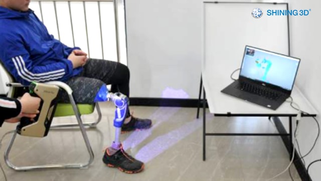 「医療活用」3Dスキャンで義足のリバースエンジニアリング