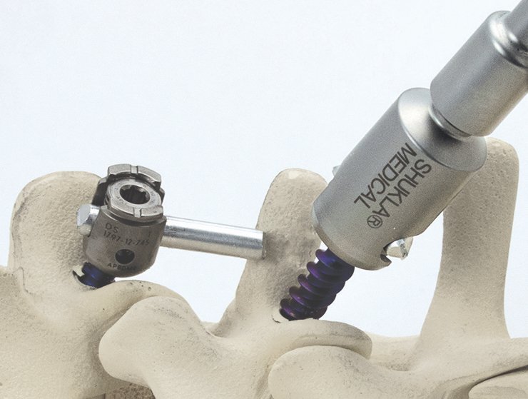 MARKFORGED METAL X 3Dプリンターを使⽤してSHUKLA MEDICALの外科⽤ツールのプロトタイプを作成